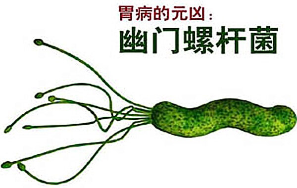 根除hp幽门螺杆菌感染，用它？比医院开的药还管用