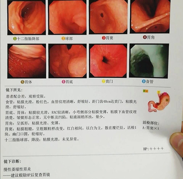 检查报告单