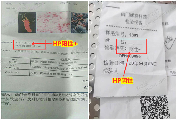 报告单