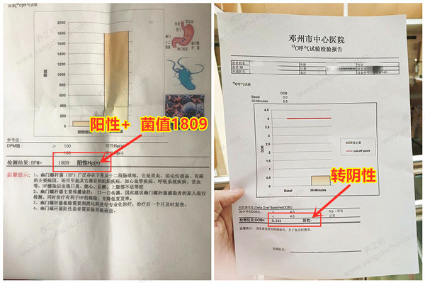 报告单