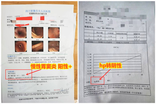 报告单