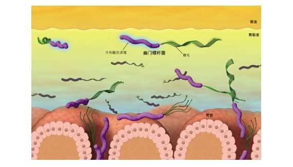 关于幽门螺旋杆菌