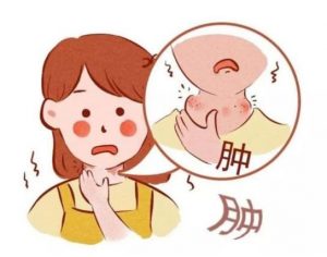 扁桃体发炎的症状以及原因，你知道有哪些吗？