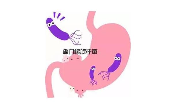 幽门螺旋杆菌自测法