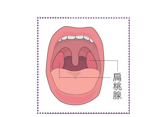 儿童割扁桃体之后,为什么会后悔呢？