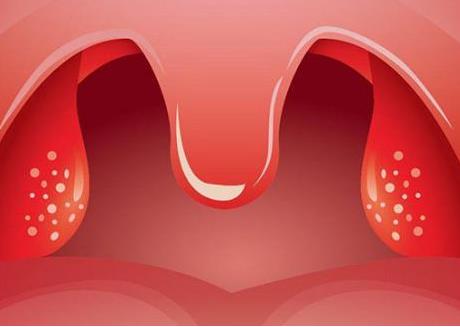 孩子扁桃体肥大，几岁才可以萎缩？