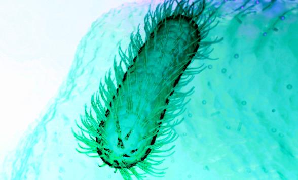 尿素酶阳性是幽门螺杆菌吗？